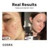 Serum Niacinamida Minimiza Poros Dilatados E Imperfecciones