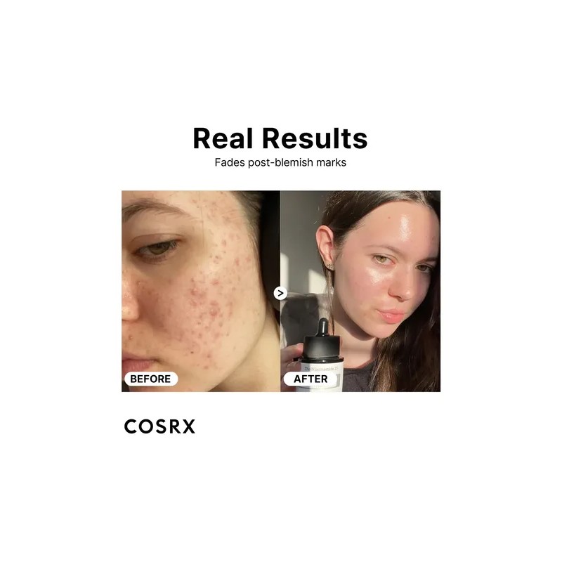 Serum Niacinamida Minimiza Poros Dilatados E Imperfecciones