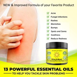 Mite-E-Blast Relief Salve Plant Powered Potent Fights Mite Insect Bite Itch Mite Woes Embrace Natural Power Neem Tea Tree Oil Goodbye Discomfort Hello to Freedom