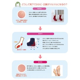 [NEW] Sun Knit Slippery Socks, Smooth Toe Base Area, Heel Slippery, Sole Exfoliating, 9.1 - 9.8 inches (23 - 25 cm), 720 NEW, Black