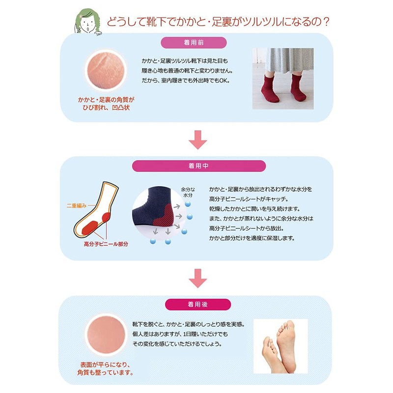 [NEW] Sun Knit Slippery Socks, Smooth Toe Base Area, Heel