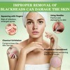 Aarivibe Blackhead Remover Mask, Bamboo Charcoal Peel Off Face Masks(120g)
