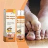 Crema Calmante Para Hongos En Las Uñas 20 Ml ×