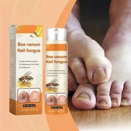 Crema Calmante Para Hongos En Las Uñas 20 Ml × 3