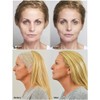 CeFurisy Collagen Silk Threads for Lifting Thread Lifting for Skin