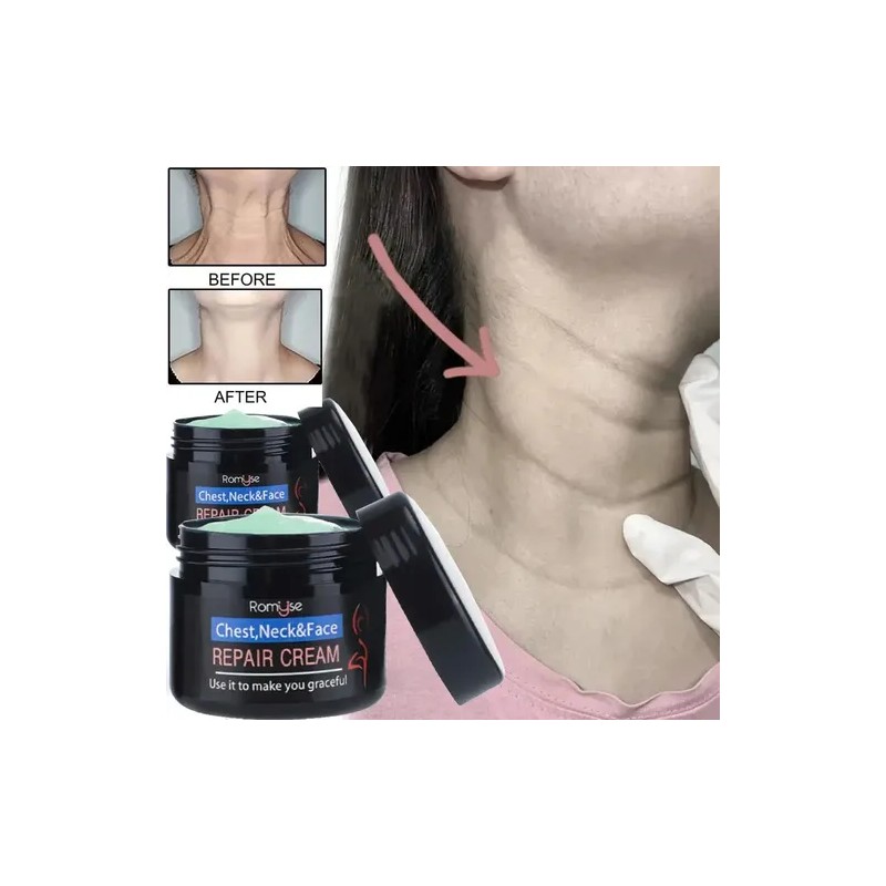 Eelhoe Crema Antiedad Para Rostro Cuello y Pecho Elimina Manchas