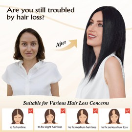 Topart 9"×9" Human Hair Toppers 16 inches for Women,100% Remy Human Hair with Multiple Non-slip Clips and Large-area Base,150% Density Top Hairpieces for Women with Thin Hair(Black)