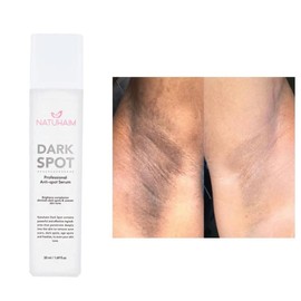 Natuhaim Dark Spot Serum - Anti-Dark Spot Serum for Skin Care, Rejuvenate with Comfort