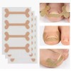 (12개입세트)테이프 내성발톱 교정기 파고드는 내향성 발톱 교정 밴드 프로 (12 Pieces Set) Nail Correction Tape for Ingrown Toenail Correction Band Pro