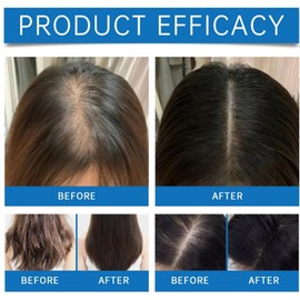 Scalp Cooling Hair Ampoule,Hair Loss Serum,Ha-Ir Density Serum,Scalp Protector,Sca-Lp Se-Rum For Dry Sca-Lp,Strengthen & Grow,Keeps Clean And Non-Greasy,Improves Shine,Lightweight,Exfoliate