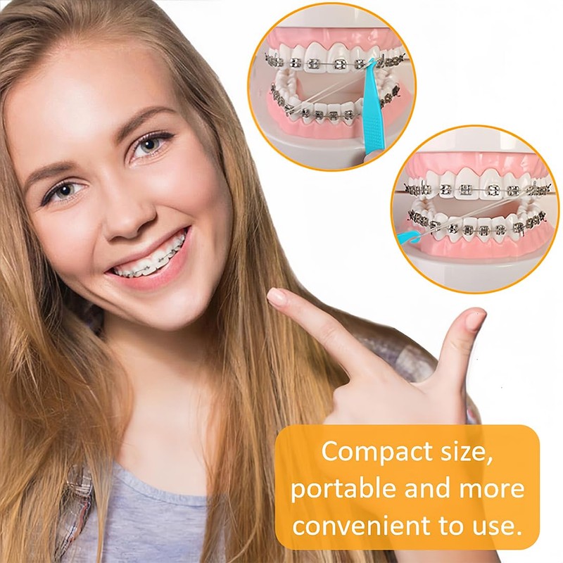 PYRUVAE Orthodontic Braces with 5 Placements, 500 Pieces Orthodontic Elastic