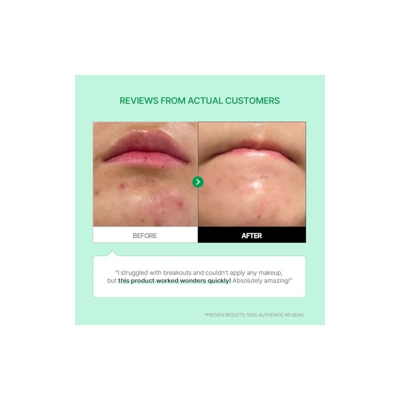 Parnell - Cicamanu 92 Serum 30ml