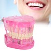 Transparent Adult Teeth Model Pathological Repair Studying Dental Teaching Tools