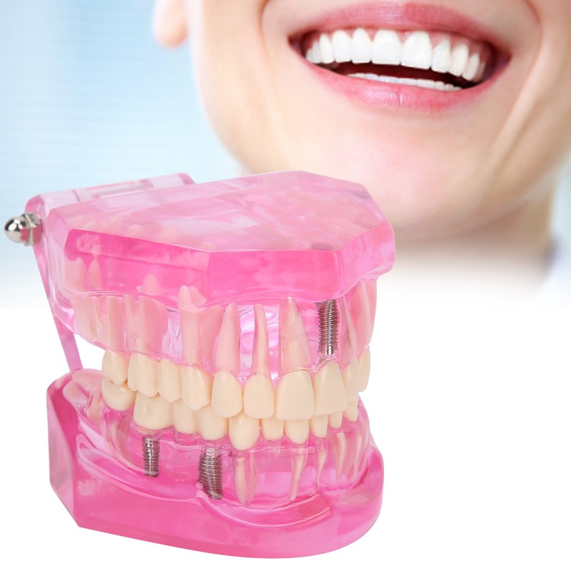 Transparent Adult Teeth Model Pathological Repair Studying Dental Teaching Tools
