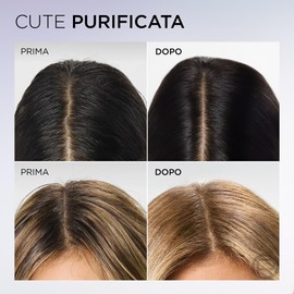 L'Oréal Paris Elvive Siero Cute Anti-Sebo, Per Cute e Radici Grasse, Azione Purificante, Cute Pulita Fino a 72h, Con Acido Salicilico e Acido Glicolico, Hyaluronic Pure, 102 ml