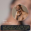 Ácido Glicólico para Peeling Facial (20% + Gel neutralizador post
