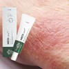 Partner company Skin Moisturizing Itching Heat Rash Eczema Centella Ingredient No Steroids 20ml Groin / 피부 보습 가려움증 땀띠 습진 센텔라성분 노 스테로이드 20ml 사타구니