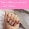 VITÉ20 Nail Clearing Gel – Apple & Sugar Extracts –