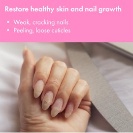 VITÉ20 Nail Clearing Gel – Apple & Sugar Extracts – Supports Healthy Nail & Skin Appearance – Nourishing, Plant-Based Repair for Brittle, Discolored Nails – Gentle Daily Care – 0.5 fl oz