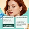 15% Mandelic Acid Serum for Face – Gentle AHA Exfoliant