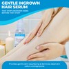 Starpil Post Wax Ingrown Hair Serum Spray 125ml/4oz - After