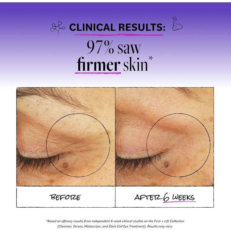 DERMA E Firming DMAE Eye Lift with Hyaluronic Acid, 0.5