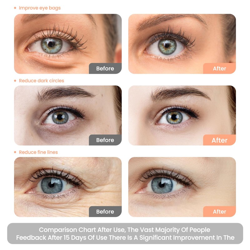 Under Eye Red Light Therapy Glasses,red Light Therapy for Eyes,