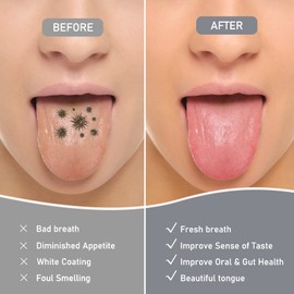 HLFLYG 4 Pack Tongue Scraper, Hygienic Seal-Pack, Professional Eliminate Bad Breath, Stainless Steel Tongue Scrapers, Effectively Improve Oral And Gut Health -silver