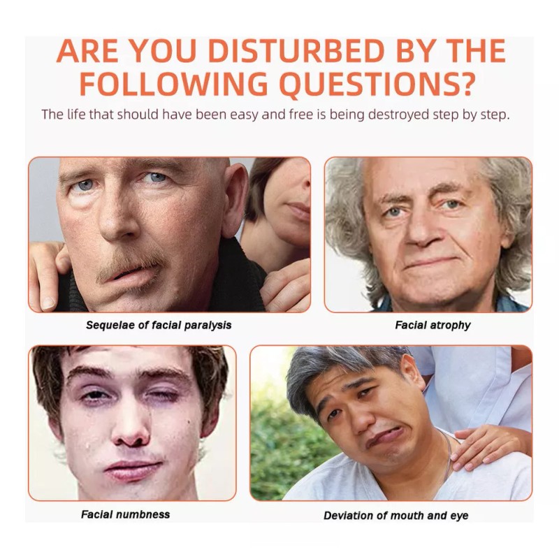56165156 5×masaje Eficaz For Corregir La Parálisis Facial Con Puntos