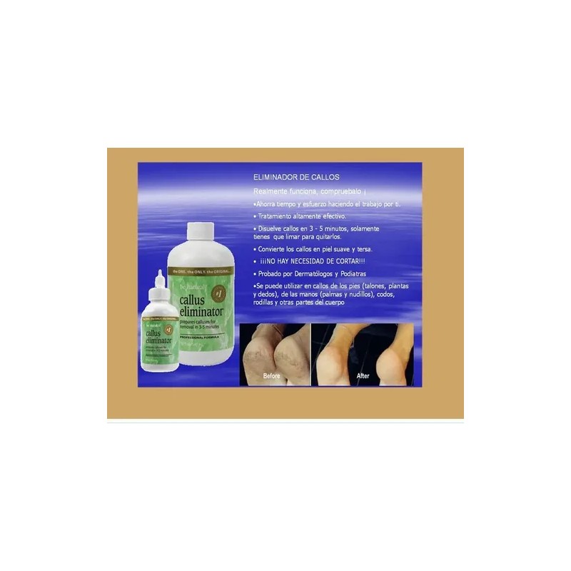 Eliminador De Callos / Callus Eliminator Be Natural 18 Oz