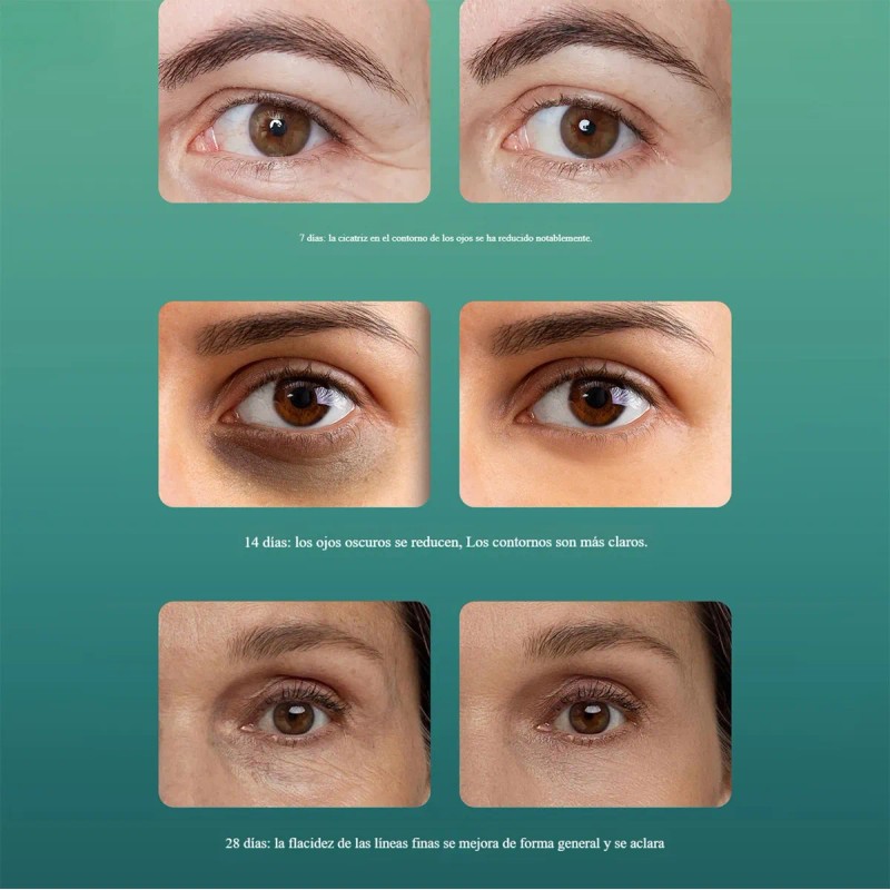 3 Cremas Reafirmantes, Hidratantes Y Antiojeras For El .kyl