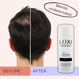 LOXI Hair Building Fibers (27.5g) | Fill In Fine, Thinning & Balding Hair for an Instantly Thicker & Fuller Look | Premium Keratin Formula | 5 Shades for Men & Women (Black).