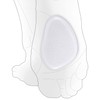 Pedimend Metatarsal Pad - 4 Pieces | Mortons Neuroma Support