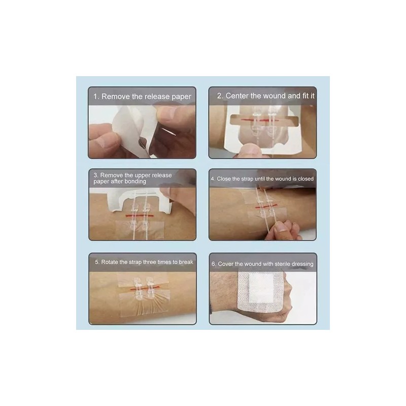 Tiras De Cierre Heridas De Emergencia,vendaje Puntada 4pcs