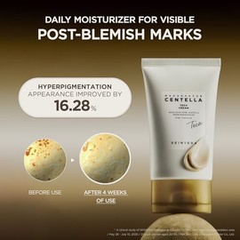 SKIN1004 Madagascar Centella TECA Cream, Korean Centella Face Moisturizer for Blemish-Prone Skin with TECA & PDRN, Cica Cream for Oil & pH Balance wit