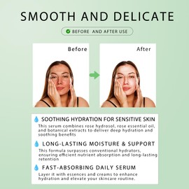 CIENNAS French Rose Essence Serum,Hydrating & Brightening Face Serum with Natural Rose Extracts, Anti-Aging, for All Skin Types - 3.4 Fl.oz