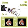 Ear Wax Removal Camera 5MP 4.2mm 70 Degree Viewing 6