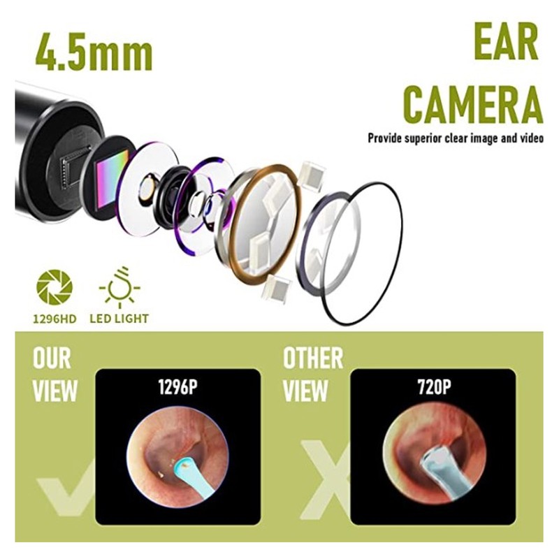 Ear Wax Removal Camera 5MP 4.2mm 70 Degree Viewing 6