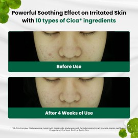 Dr.G Dr.G Red Blemish Clear Soothing Korean Moisturizer Face Cream, 70ml - Cica Cream, Korean Skin Care Moisturizer, Korean Face Moisturizer, Facial Moisturizer, Korean Skincare, K Beauty Skincare Coreano