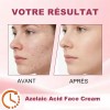 Sérum De Ácido Azelaico 20 G, Reduce Las Imperfecciones