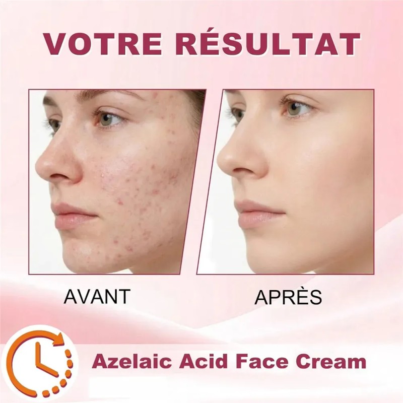 Sérum De Ácido Azelaico 20 G, Reduce Las Imperfecciones