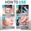 Professional Blackhead Extractor Tool (Stainless Steel) Pimple Popper for Acne,