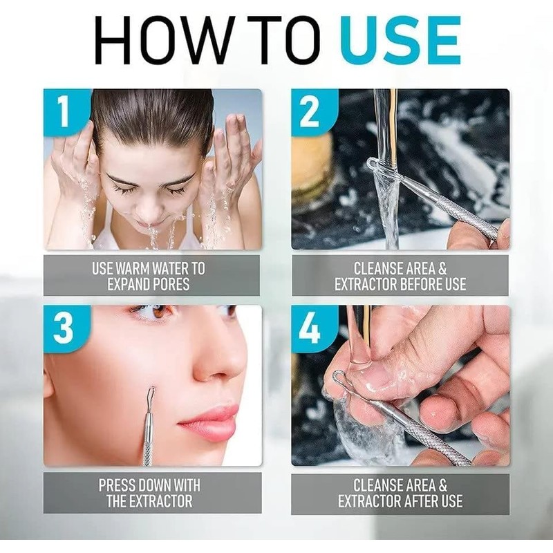 Professional Blackhead Extractor Tool (Stainless Steel) Pimple Popper for Acne,