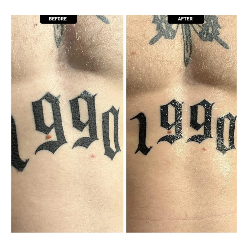 Mad Rabbit Reparación - Gel Calmante E Hidratante Para Tatua