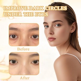 Augenringe Entfernen Augenringe Augencreme Gegen Falten und Augenringe Augencreme Gegen Tränensäcke Reduzieren Sie Tränensäcke Falten und Feine Linien für Alle Hauttypen Geeignet