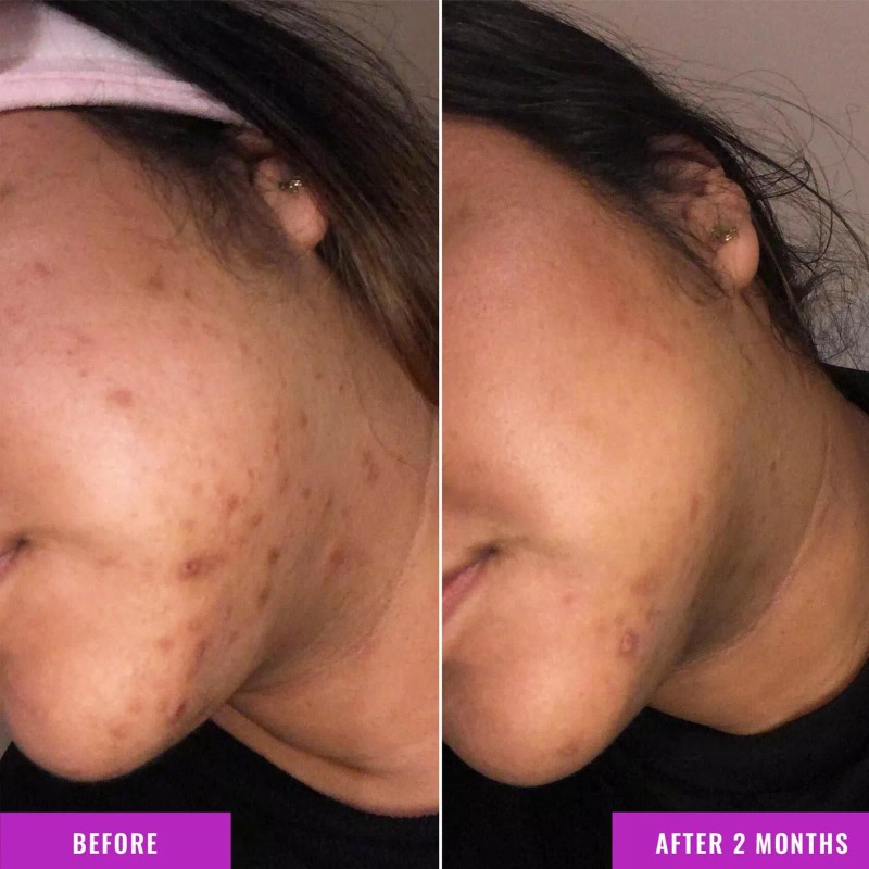 Good Molecules Discoloration Correcting Serum Brighten Even Skin Tone 1Oz