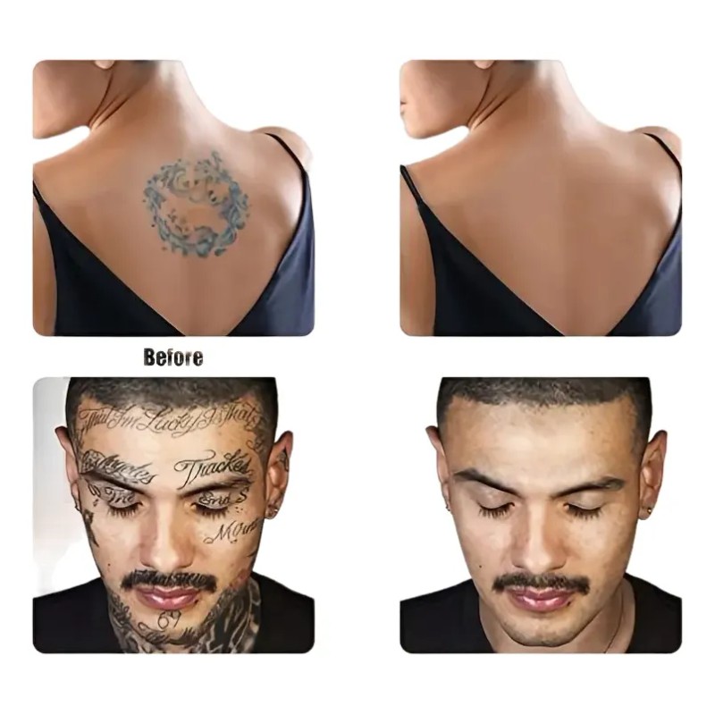 Profesional Maquillaje Cubre Tatuajes Cicatrices Acné Tatoos Bicolor