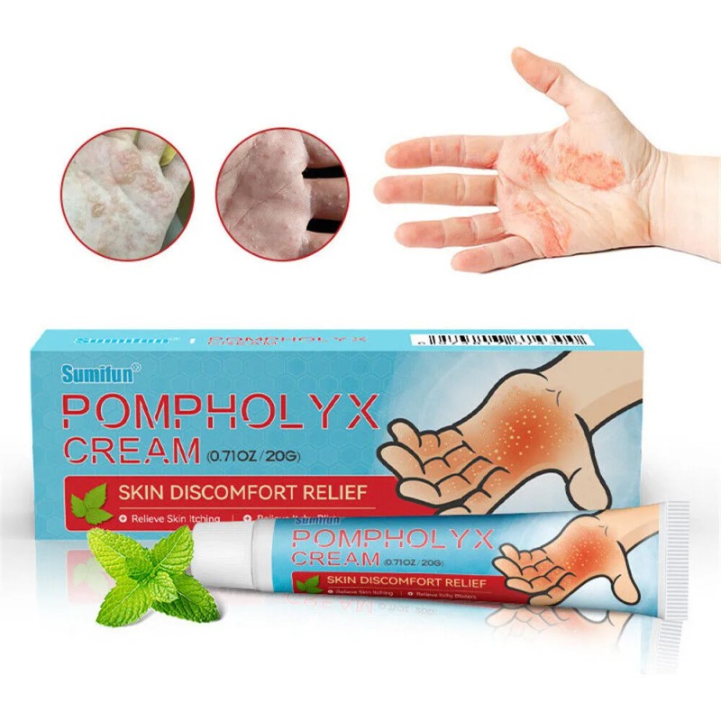 Ungüento Antipruriginoso Para La Dishidrosis De La Piel No