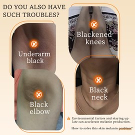 Skin Brightening Cream for Women - Body Lotion for Intimate Areas, Underarms & Private Parts - Deep Hydration, Improve Dullness & Evens Skin Tone - Radiant Glow