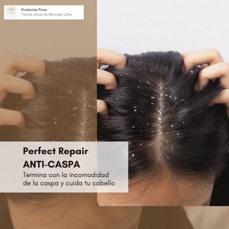 2 Shampoo Edengi Anti-caspa Eficaz Y Protector De Tu Cabello